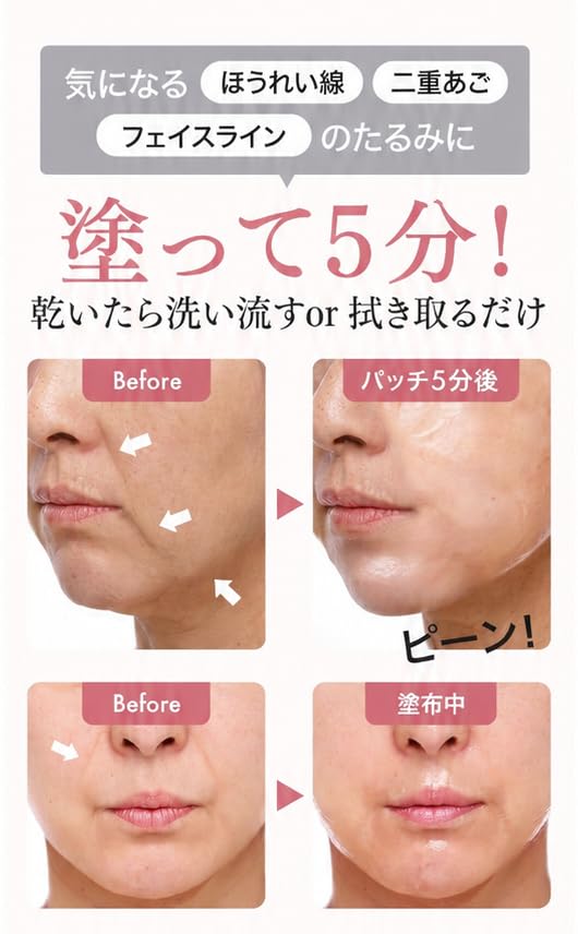 口元 たるみ 引き締め ほうれい線 リストアップ機器 幹細胞 美容液 /オマケ有 Amazon.co.jp: ほうれい線 口角 塗るだけで引き上がる リフトアップ